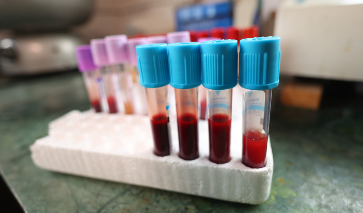 POST PTCA/ CABG / VALVE