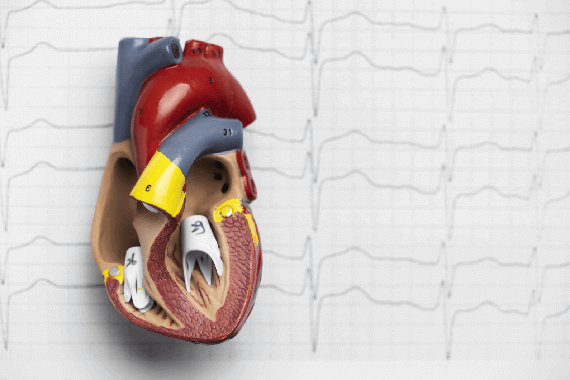 Closure of Intracardiac Defects ASD, VSD, PDA, AV Malformations