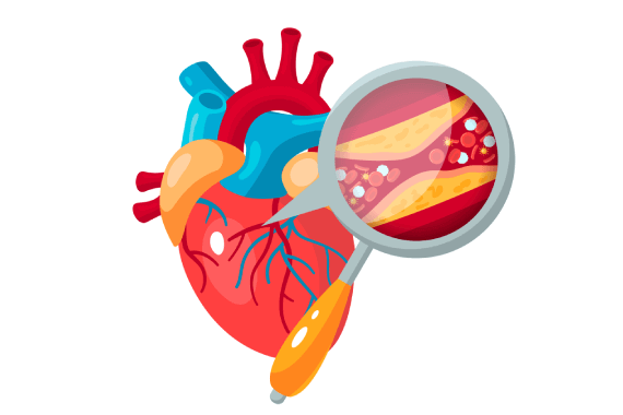 Valve Replacements and Repair