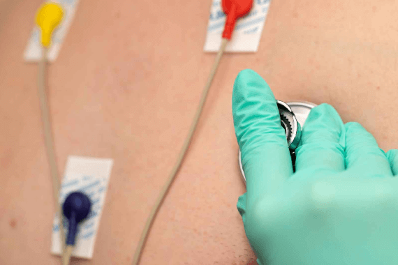 12 Leads 24 hours ambulatory Electrocardiography (Holter)